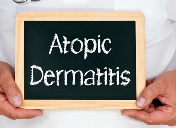 Lečenje atopijskog dermatitisa - značaj pimekrolimusa