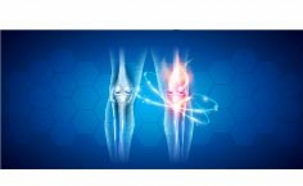 Osteoartritis kolena i tretman bola - primena kristalnog glukozamin sulfata