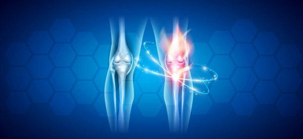 Lečenje osteoartritisa kolena