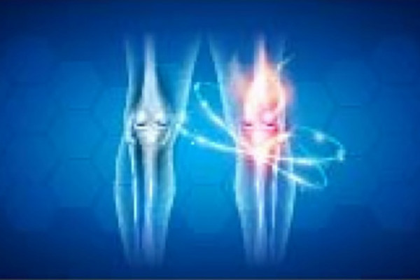 Primena kristalnog glukozamin sulfata u terapiji osteoartritisa kolena i terapija bola
