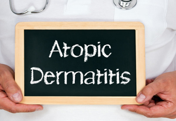 Značaj pimekrolimusa u lečenju atopijskog dermatitisa