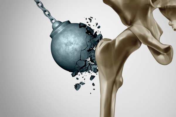 Prevencija, dijagnostika i lečenje osteoporoze